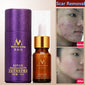 Scar Repair Skin Essential Oil Lavender Essence Skin Care Natural Pure Remove Ance Burn Strentch Marks Scar Removal 10ML