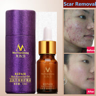 Scar Repair Skin Essential Oil Lavender Essence Skin Care Natural Pure Remove Ance Burn Strentch Marks Scar Removal 10ML